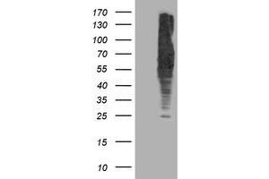 HEK293T cells were transfected with the pCMV6-ENTRY control (Left lane) or pCMV6-ENTRY DLD (Right lane) cDNA for 48 hrs and lysed. (DLD antibody)