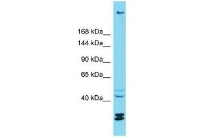 Host: Rabbit Target Name: KIAA1551 Sample Type: ACHN Whole cell lysates Antibody Dilution: 1. (KIAA1551 antibody  (C-Term))