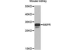 Western blot analysis of extracts of mouse kidney, using M6PR antibody. (M6PR antibody)