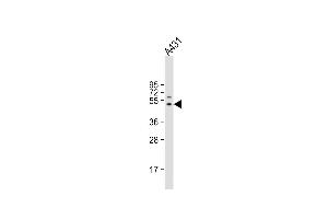 Anti-FIBG Antibody (C-term) at 1:4000 dilution + A431 whole cell lysate Lysates/proteins at 20 μg per lane. (FGG antibody  (C-Term))