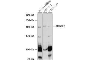 Western blot analysis of extracts of various cell lines, using  antibody (ABIN6127521, ABIN6136573, ABIN6136574 and ABIN6220870) at 1:1000 dilution. (G Protein-Coupled Receptor 116 antibody  (AA 22-280))
