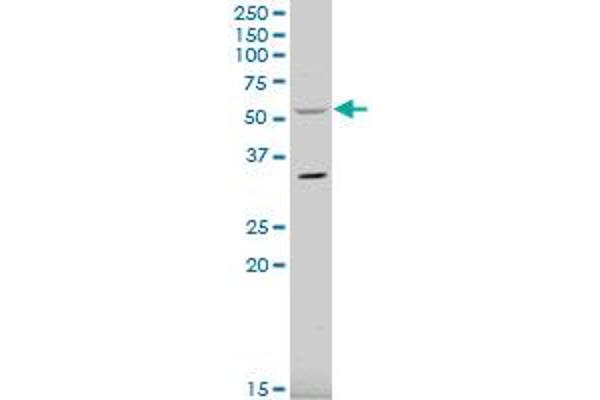 RCBTB2 antibody  (AA 86-194)
