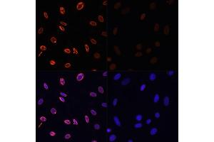 Immunofluorescence analysis of NIH/3T3 cells using Acetyl-Histone H3-K36 antibody (ABIN7267671) at dilution of 1:100. (Histone 3 antibody  (H3K36))