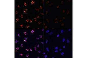 Immunofluorescence analysis of NIH/3T3 cells using Acetyl-Histone H3-K36 antibody (ABIN7267671) at dilution of 1:100. (Histone 3 antibody  (H3K36))