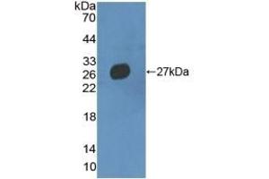 Detection of Recombinant MMRN2, Mouse using Polyclonal Antibody to Multimerin 2 (MMRN2) (MMRN2 antibody  (AA 23-188))