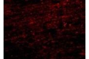Immunofuorescence of CLIP170 in human brain tissue with AP30237PU-N CLIP170 antibody at 20 μg/ml. (CLIP1 antibody  (C-Term))