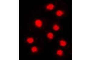 Immunofluorescent analysis of Cyclin A1 staining in MCF7 cells. (Cyclin A1 antibody  (C-Term))