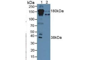 Rabbit Detection antibody from the kit in WB with Positive Control: Sample Lane1: Human Serum; Lane2: Human Liver Tissue.