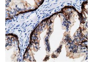 Immunohistochemical staining of paraffin-embedded Human colon tissue using anti-CRYM mouse monoclonal antibody.