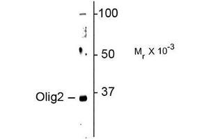 Image no. 1 for anti-Oligodendrocyte Lineage Transcription Factor 2 (OLIG2) antibody (ABIN372693)