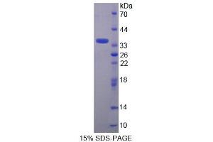 SDS-PAGE (SDS) image for Alanine Glyoxylate Aminotransferase 2 (AGXT2) (AA 226-513) protein (His tag) (ABIN6239347) (AGXT2 Protein (AA 226-513) (His tag))