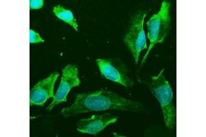 IF analysis of PLD2 using anti-PLD2 antibody (ABIN7601520).