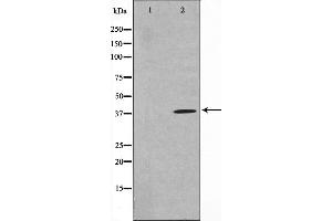 Western blot analysis on HuvEc cell lysate using TNFSF11 Antibody.