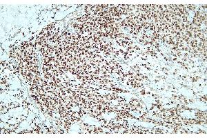Immunohistochemistry (IHC) image for anti-SRY (Sex Determining Region Y)-Box 10 (SOX10) (C-Term) antibody (ABIN7598799) (SOX10 antibody  (C-Term))