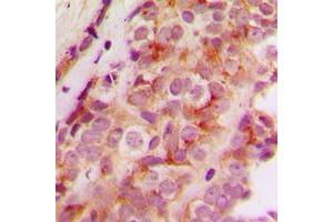 Immunohistochemistry (IHC) image for anti-Junction Mediating and Regulatory Protein, P53 Cofactor (JMY) (C-Term) antibody (ABIN7300900)