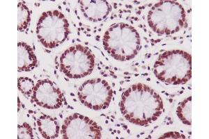 Immunohistochemical analysis of paraffin-embedded human colon, using Phospho-DNA PKcs (S2056) Antibody. (Recombinant PRKDC antibody  (pSer2056))