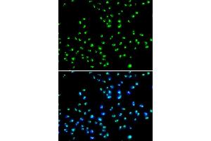 Immunofluorescence analysis of MCF-7 cells using N antibody (ABIN6132968, ABIN6144376, ABIN6144377 and ABIN6223123). (NAT10 antibody  (AA 1-250))
