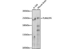 Western blot analysis of extracts of various cell lines, using TUBGCP6 antibody (ABIN7271055) at 1000 dilution. (GCP6 antibody  (AA 600-900))