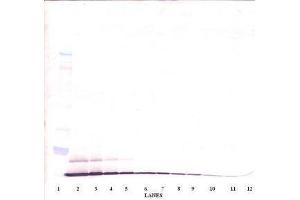 Image no. 4 for anti-Chemokine (C-C Motif) Ligand 20 (CCL20) antibody (ABIN465457)