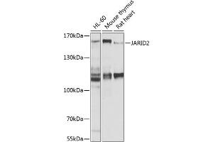 Western blot analysis of extracts of various cell lines, using J antibody (ABIN6129402, ABIN6142653, ABIN6142654 and ABIN6225131) at 1:1000 dilution. (JARID2 antibody  (AA 1027-1246))