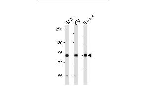 All lanes : Anti-RSK3 Antibody (N-term) at 1:2000 dilution Lane 1: Hela whole cell lysate Lane 2: 293 whole cell lysate Lane 3: Ramos whole cell lysate Lysates/proteins at 20 μg per lane. (RPS6KA3 antibody  (N-Term))