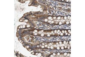 Immunohistochemical staining of human rectum with NSUN7 polyclonal antibody  shows moderate cytoplasmic positivity in glandular cells at 1:20-1:50 dilution. (NSUN7 antibody)