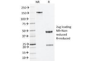SDS-PAGE Analysis Purified Nucleophosmin Mouse Monoclonal Antibody (NA24). (NPM1 antibody  (N-Term))