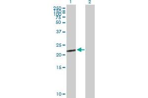 Western Blot analysis of CGB5 expression in transfected 293T cell line by CGB5 MaxPab polyclonal antibody. (CGB5 antibody  (AA 1-165))