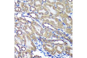 Immunohistochemistry of paraffin-embedded Mouse kidney using  Rabbit pAb (ABIN7265603) at dilution of 1:100 (40x lens). (ANKLE2 antibody  (AA 350-450))