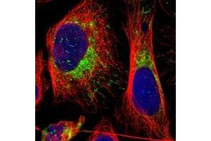 Immunofluorescent staining of human cell line U-2 OS with MRPL45 polyclonal antibody  at 1-4 ug/mL dilution shows positivity in mitochondria. (MRPL45 antibody)