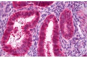 Anti-PCK1 antibody IHC staining of human uterus, endometrium. (PCK1 antibody)