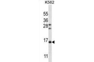 Western Blotting (WB) image for anti-Follicle Stimulating Hormone, beta Polypeptide (FSHB) antibody (ABIN2997110) (FSHB antibody)