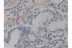 Immunohistochemistry (IHC) image for anti-Actin, gamma 2, Smooth Muscle, Enteric (ACTG2) (AA 3-376) antibody (ABIN7440569)