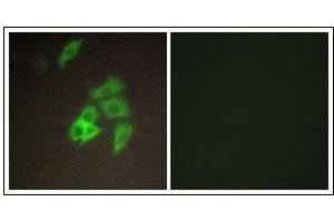 Immunofluorescence analysis of A549 cells, using ST14 Antibody. (ST14 antibody  (N-Term))