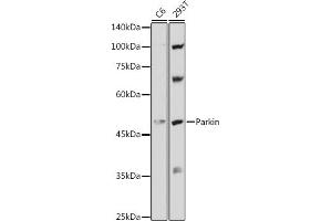 Western blot analysis of extracts of various cell lines, using Parkin antibody (ABIN6132295, ABIN6145226, ABIN6145227 and ABIN6215092) at 1:1000 dilution. (Parkin antibody  (AA 1-300))