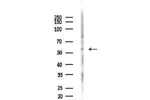 anti-Glycerol Kinase (GK) (C-Term) antibody
