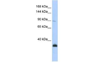 WB Suggested Anti-MORC3 Antibody Titration:  0. (MORC3 antibody  (N-Term))