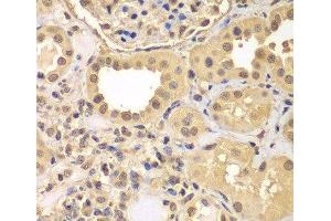 Immunohistochemistry of paraffin-embedded Human kidney using ARNT2 Polyclonal Antibody at dilution of 1:100 (40x lens). (ARNT2 antibody)