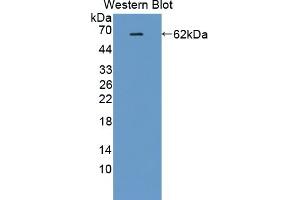 Detection of Recombinant IK, Human using Polyclonal Antibody to IK Cytokine, Down Regulator Of HLA II (IK) (Protein Red (IK) (AA 1-192) antibody)