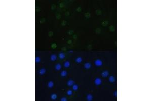 Immunofluorescence analysis of H9C2 cells using Phospho-Histone H3-S28 antibody (ABIN7267689) at dilution of 1:100.