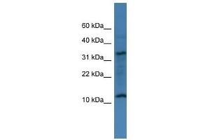 Western Blot showing C14orf177 antibody used at a concentration of 1-2 ug/ml to detect its target protein. (C14ORF177 antibody  (N-Term))