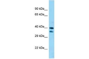 WB Suggested Anti-Sav1 Antibody Titration: 1.