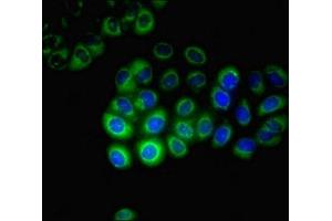 Immunofluorescent analysis of A549 cells using ABIN7170749 at dilution of 1:100 and Alexa Fluor 488-congugated AffiniPure Goat Anti-Rabbit IgG(H+L) (CYP17A1 antibody  (AA 1-508))