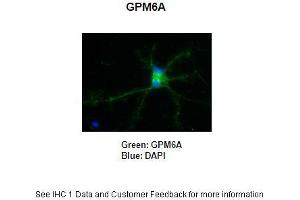Primary Antibody Dilution: 1:250Secondary Antibody: Anti-rabbit-AlexaFluor 488 Secondary Antibody Dilution: 1:5000Color/Signal Descriptions: GPM6A: Green DAPI: Blue  Gene Name: GPM6A Submitted by: Anonymous (GPM6A antibody  (C-Term))
