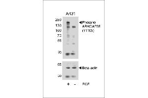 Western blot analysis of lysates from A431 cell line, untreated or treated with EGF, 100 ng/mL, using Phospho-HUN-ARHG (ABIN6241039 and ABIN6578944) (upper) or Beta-actin (lower). (GRLF1 antibody  (pTyr1105))