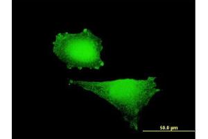 Immunofluorescence of purified MaxPab antibody to HIF1A on HepG2 cell. (HIF1A antibody  (AA 1-735))