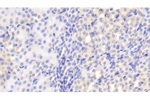 Detection of CLTA in Mouse Kidney Tissue using Polyclonal Antibody to Clathrin, Light Polypeptide A (CLTA) (CLTA antibody  (AA 5-234))