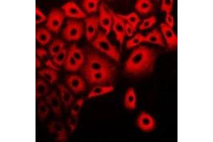 Immunofluorescent analysis of Calpain 5 staining in A549 cells. (Calpain 5 antibody)