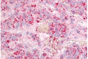 Human Anterior Pituitary (formalin-fixed, paraffin-embedded) stained with GPR12 antibody ABIN213424 at 10 ug/ml followed by biotinylated goat anti-rabbit IgG secondary antibody ABIN481713, alkaline phosphatase-streptavidin and chromogen. (G Protein-Coupled Receptor 12 antibody  (Extracellular Domain))