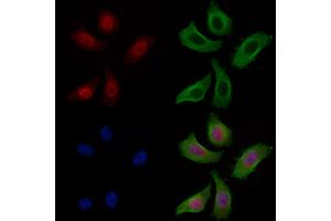 ABIN7093314 and ABIN7097333 staining Hela cells by IF/ICC. (p53 antibody  (C-Term))